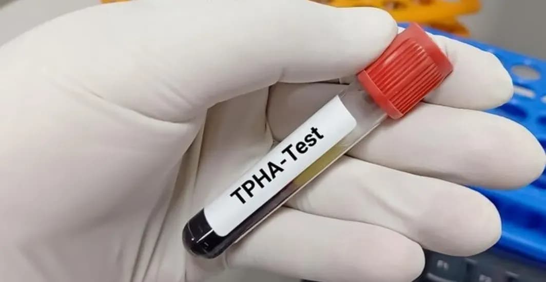 TPHA
