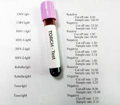 Torch Test