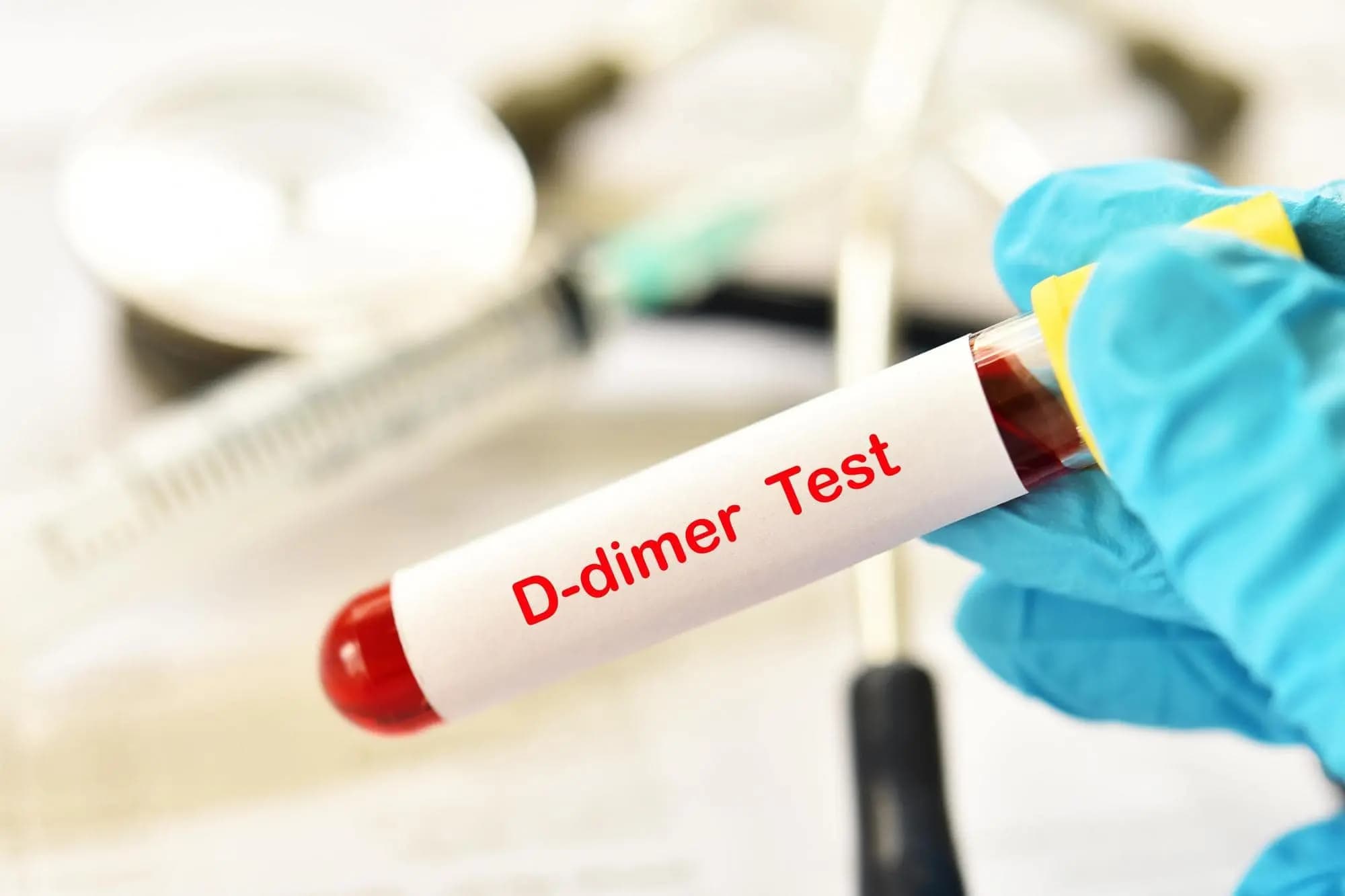  D_Dimer 