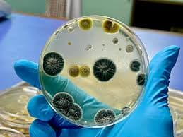 Fungal Cultural and Sensitivity Test