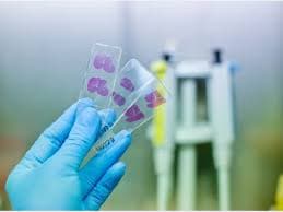 Histopathology Examination-Cervical Biopsy