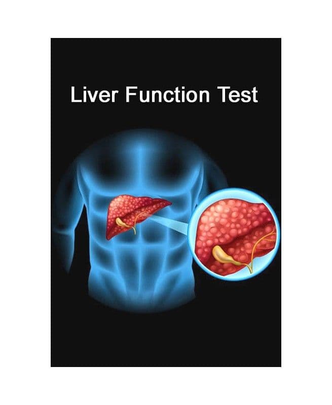 Liver Function Test (LFT) with GGT