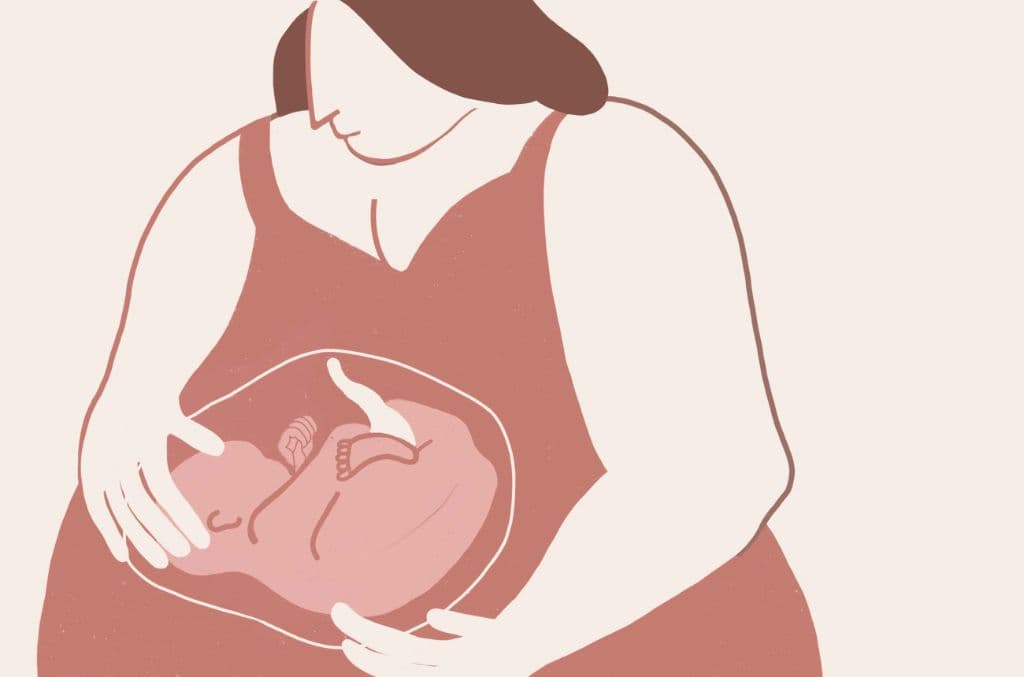 Maternal Obesity Can Lead to Complications in Newborn
