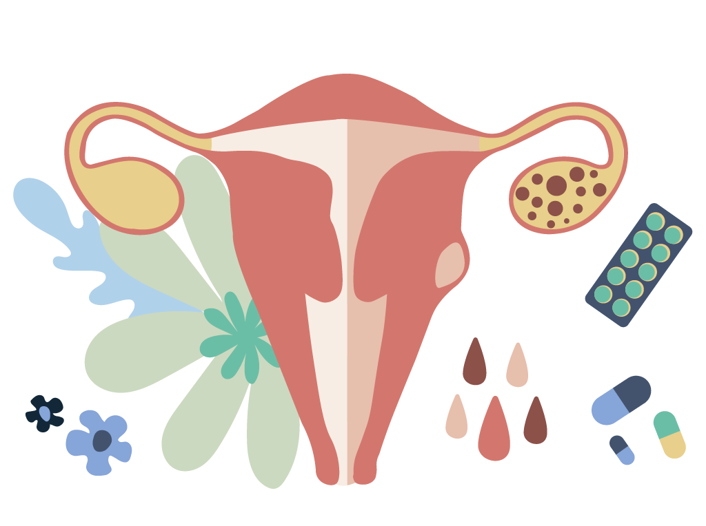 Practice the Science of Yoga to Eliminate PCOS