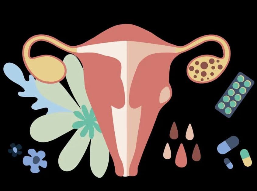 Medications for PCOS